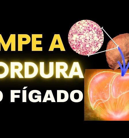 limpar a gordura no fígado